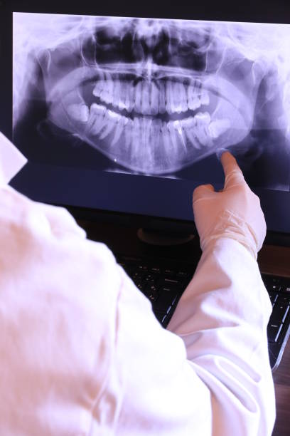 Best Emergency Wisdom Teeth Removal in Sammamish, WA