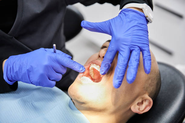 Best Emergency Treatment for Dental Infections or Abscesses in Sammamish, WA